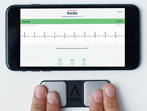 AliveCor