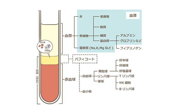 血液のがん